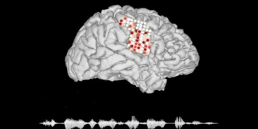 beyin-sinyallerini-sese-donusturen-implant-gelistirildi-ng5zrJf7.jpg